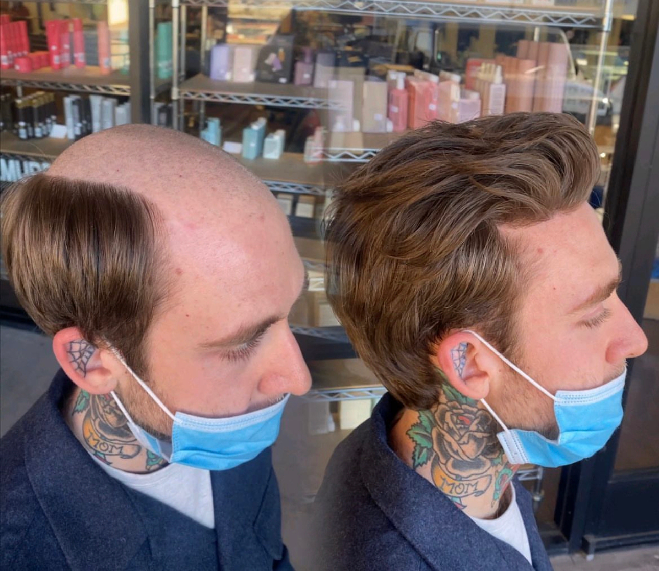 Hair system consultation step in Bossier City, Louisiana